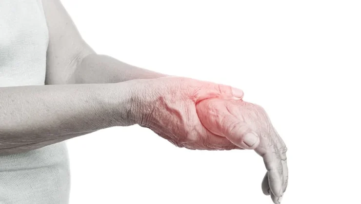 Nerve Damage
