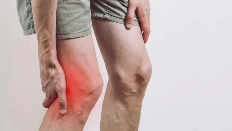 Ligament