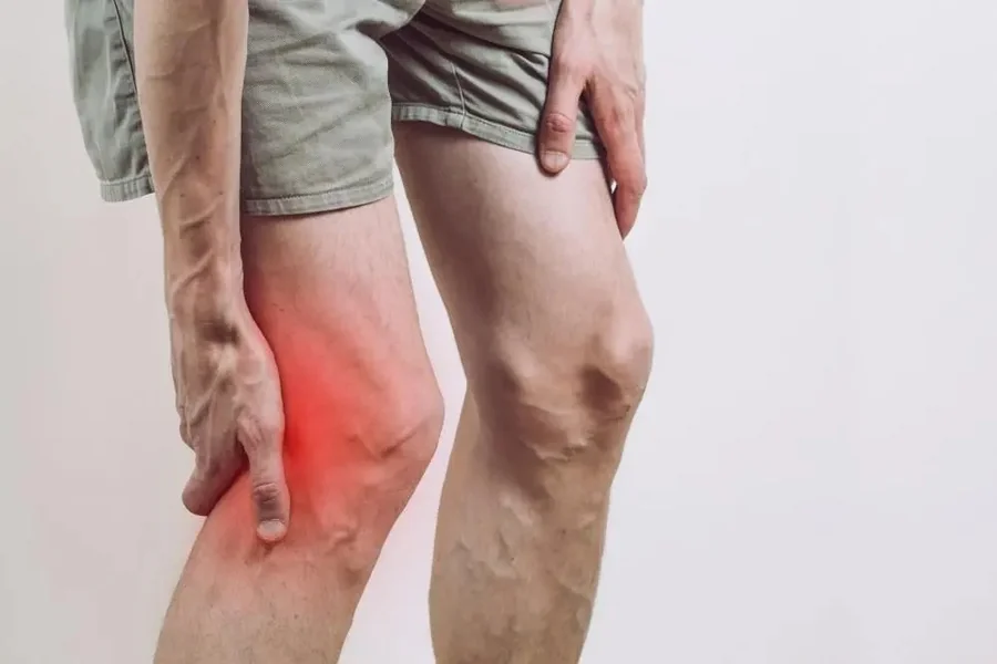 Ligament