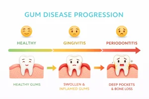 Signs of Gum Disease and the Latest Treatments Available