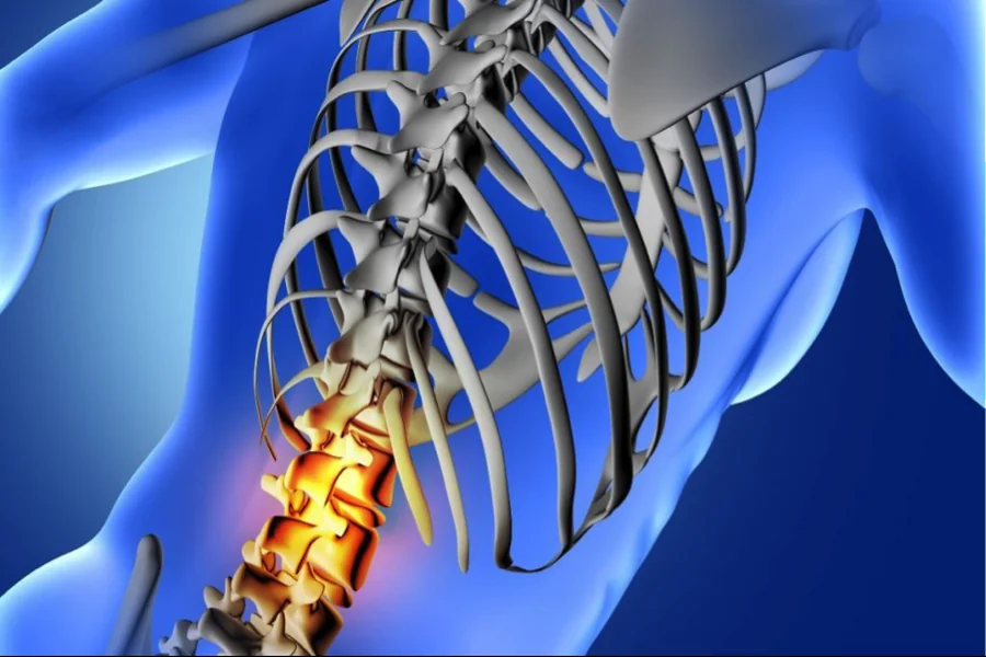 The Medical Evidence Behind a Strong Spinal Cord Injury Claim